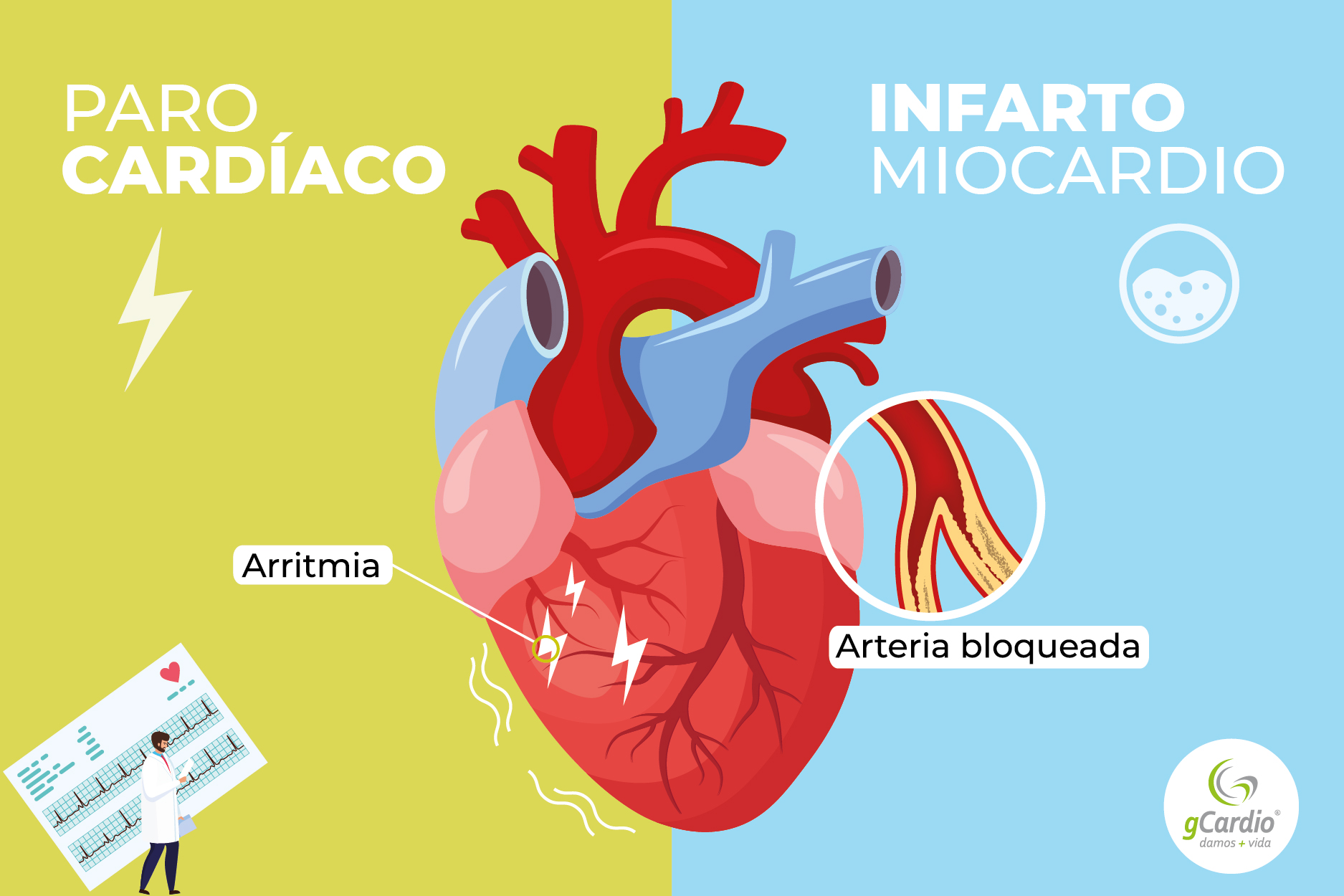 «Hoja de ruta» para reducir la mortalidad por infarto Infoargentina